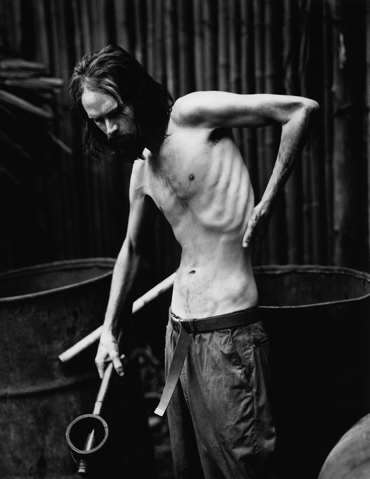 Black and white photo: An extremely thin, emaciated young man with his upper body exposed. His ribs are clearly visible.